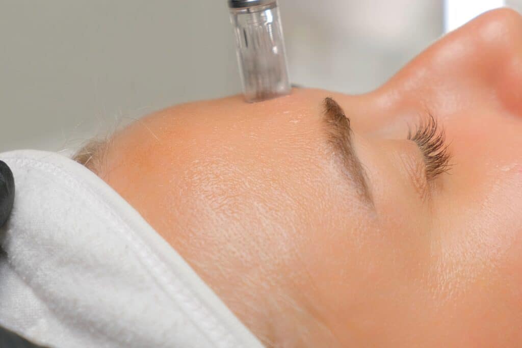 Microneedle treatment